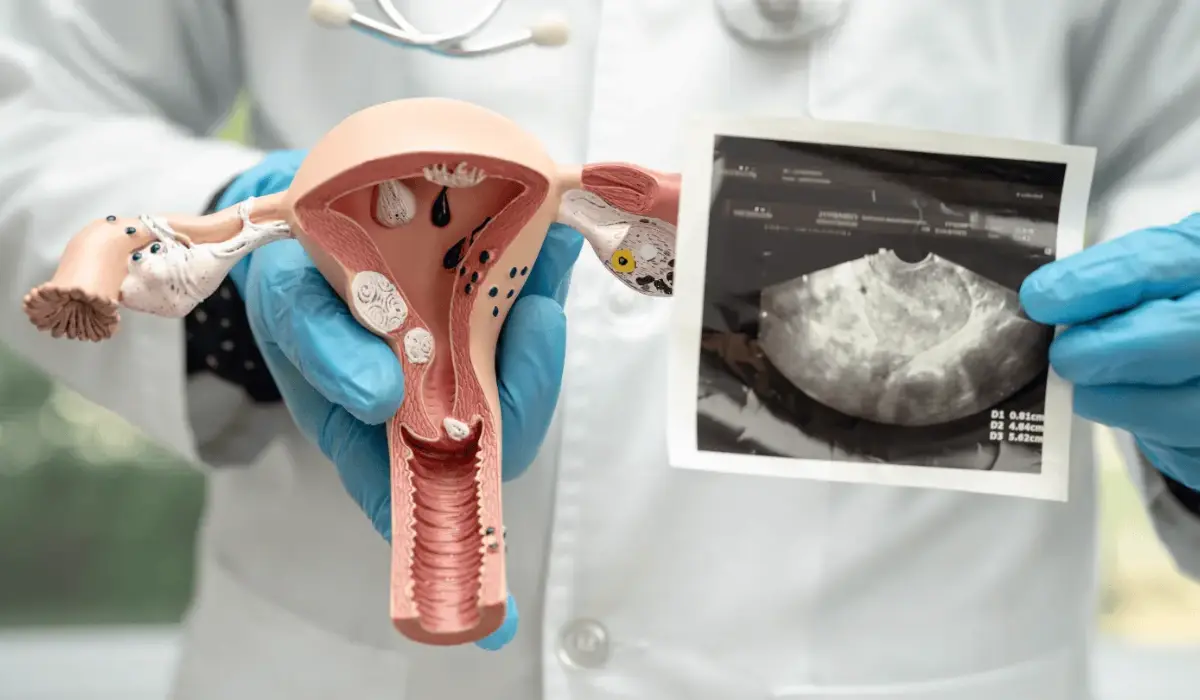 Cervical Carcinoma: Can Ultrasound Be Used to Detect Cervical Cancer?