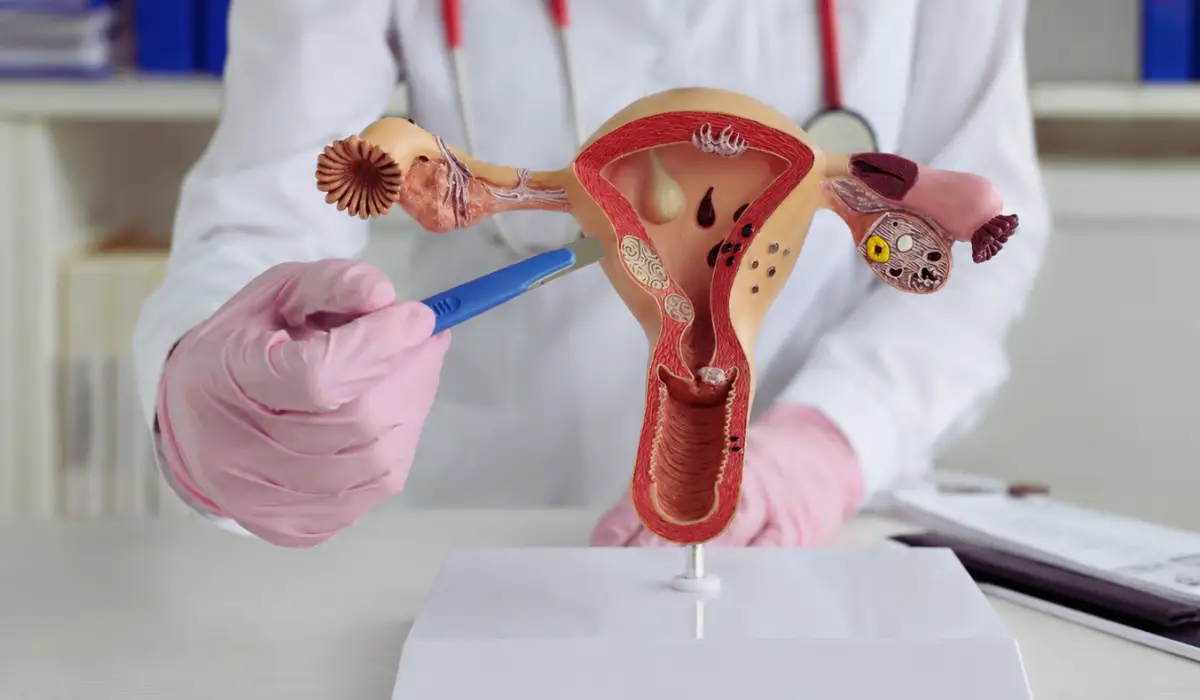 Does A Hysterectomy Cure Endometriosis? Pain Relief, And Risks